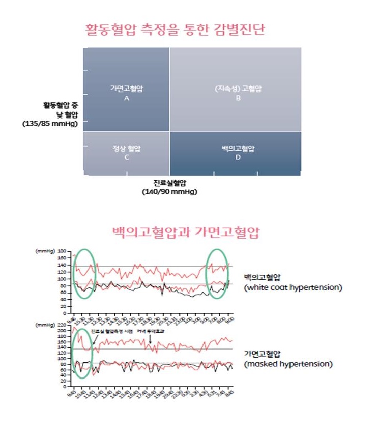 레드써클 정보 톡톡(Talk, Talk) - 24시간 활동혈압 측정 3
